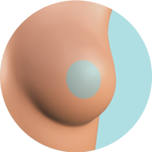 Areola