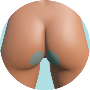 Intergluteos